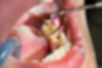 Endodontics