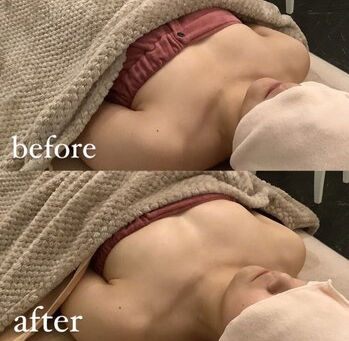 バスト高さ出し/リフトアップ/育乳/バストアップ