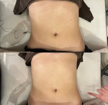 バストアップしながらくびれもゲット？