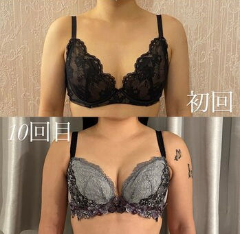 ご継続のお客様症♪/育乳/バストアップ