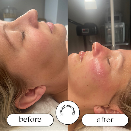 Keeley B&A