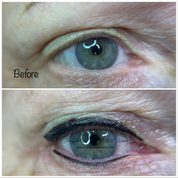 eyeliner tattoo correction
