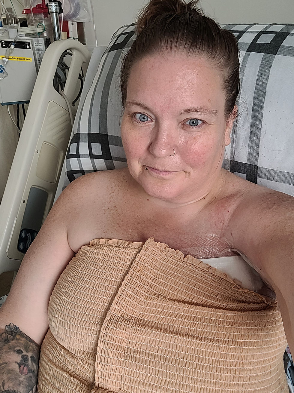 This was a day or two after surgery - color had come back to my cheeks (even though my hemoglobin was critically low) but I felt good and sent this pic to my sister and mom to show I was a bit more "alive"