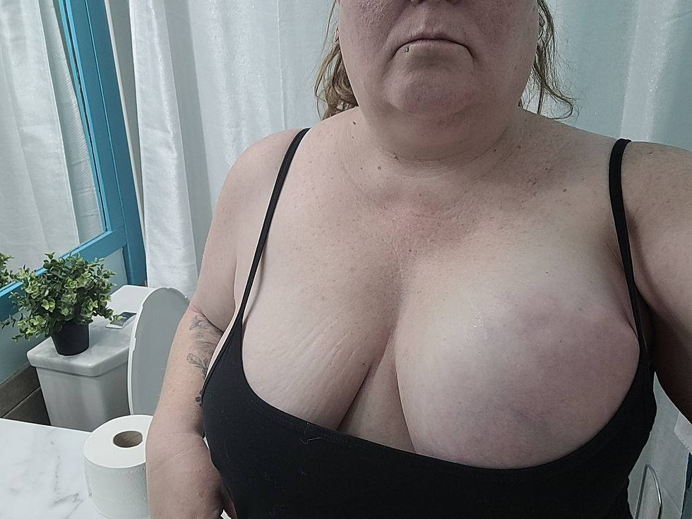 This was taken the morning before the aspiration took place.