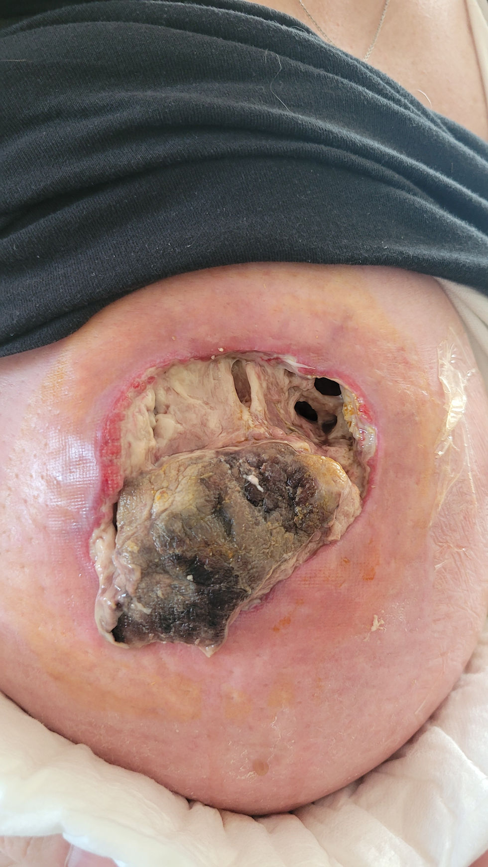 Who knew a body could do this? (Taken August 26)
