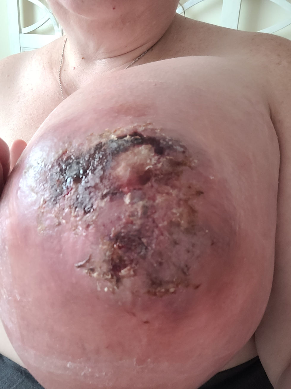 August 8 - the day after I saw Dr. Raoubi