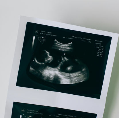 After Leaving The Occult, A Therapist Told Me To Abort My Child