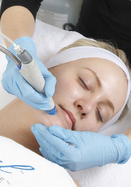 HydraFacial device handpiece — treatment room equipment