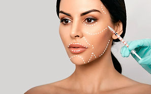 dermal-filler-areas.jpg