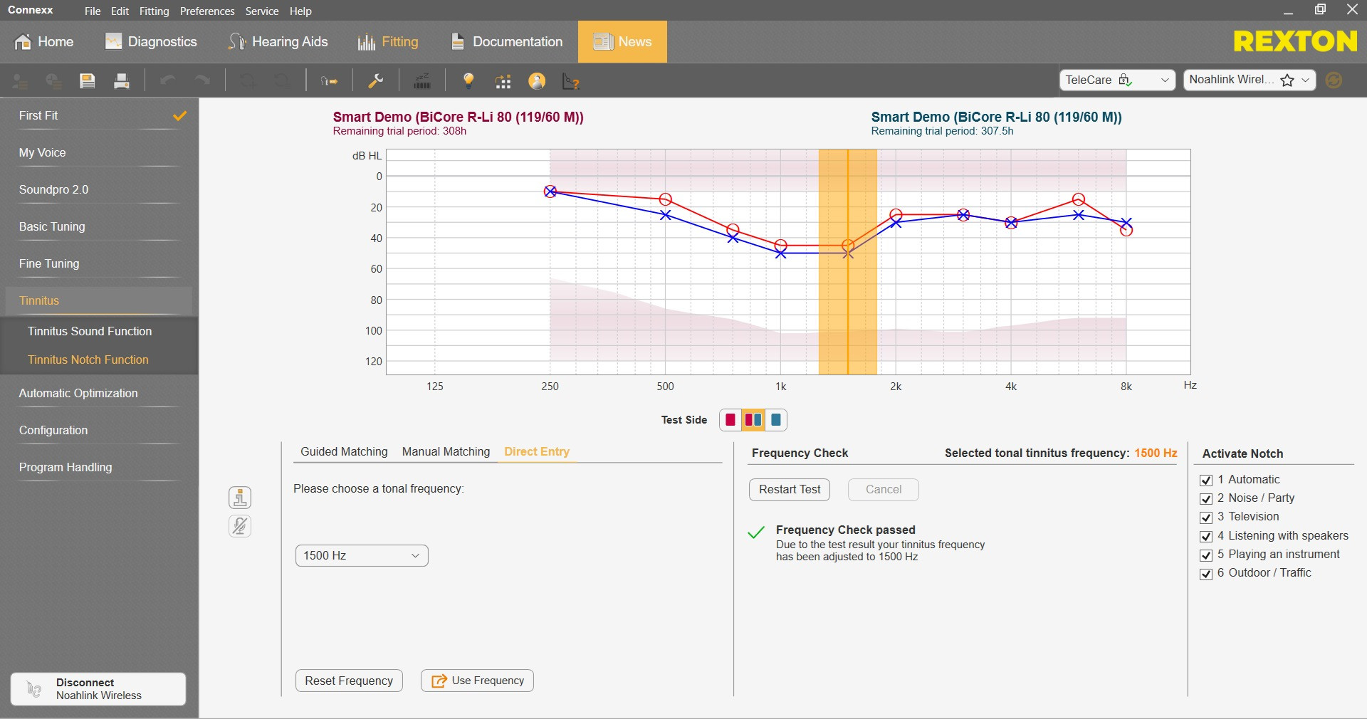 what is notch therapy for tinnitus