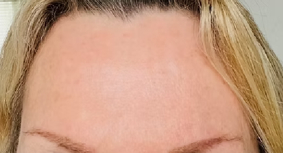 wrinkle_after.png