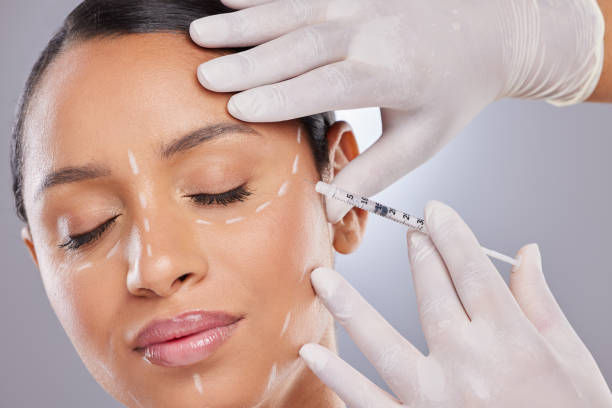 Dermal Fillers