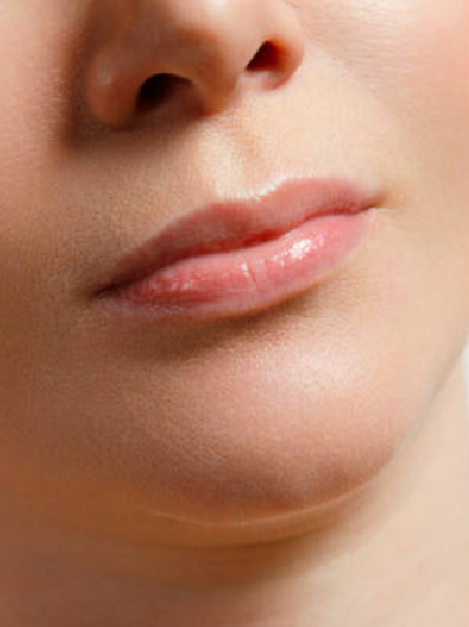 lips_before.png