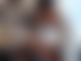 Hair Systems vs. Hair Transplants