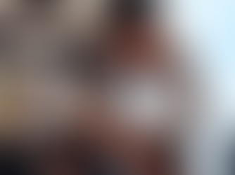 Hair Systems vs. Hair Transplants