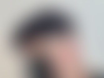 Regain Your Confidence with Non-Surgical Hair Systems