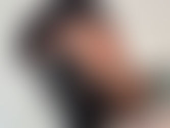 ❄️ Winter-Proof Your Confidence: The Ultimate Guide to Hair System Care in Cold Weather