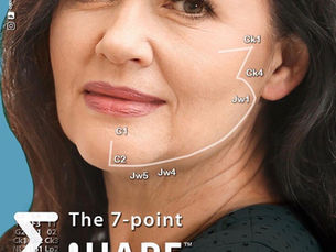 How the 7-Point Shape injection technique lifts your face without surgery