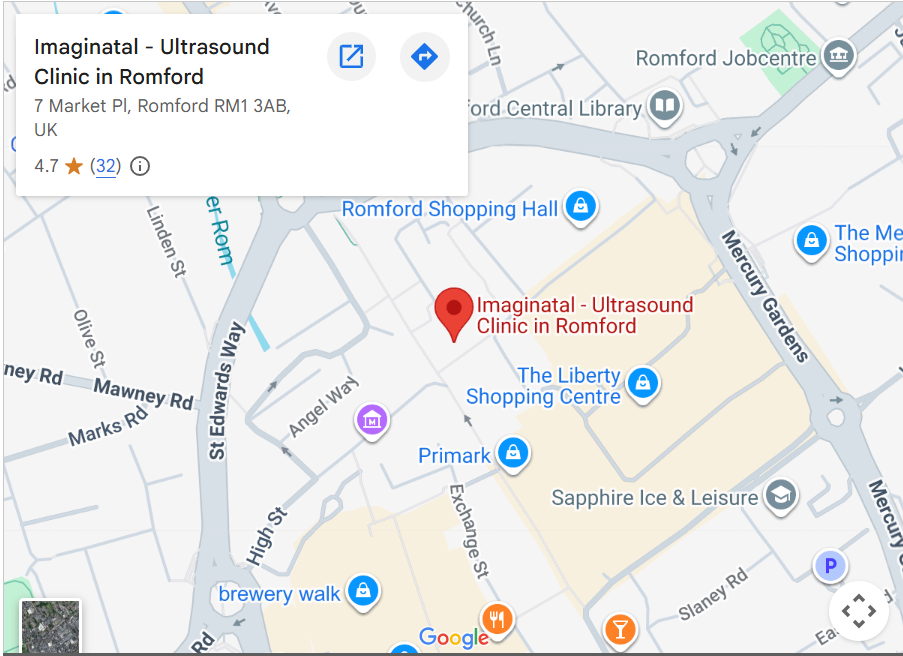 What Are the Advantages of a Private Pregnancy Ultrasound?