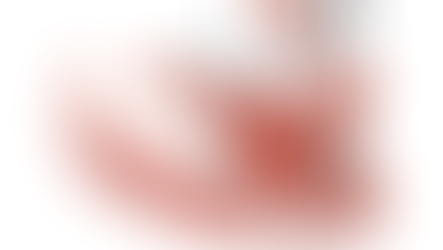 All on Four - Todos los dientes sobre 4 implantes monofásicos de carga inmediata en Bogotá.