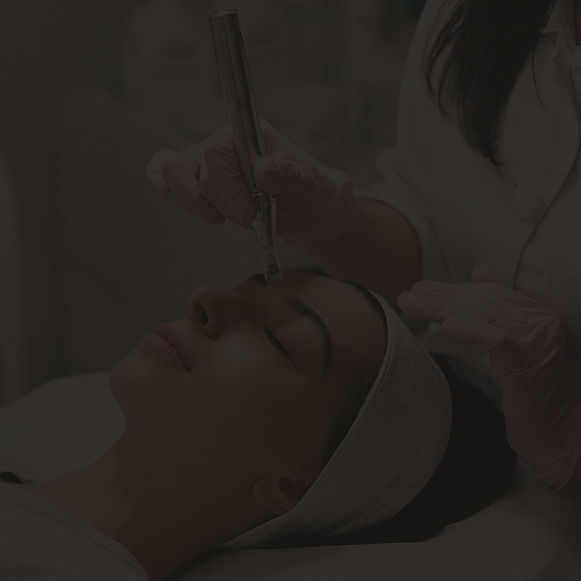#microneedling #metrocentre#beautifulskin_edited.jpg