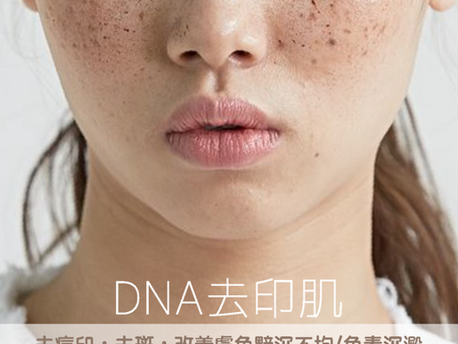 DNA 去印肌