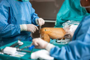 Process surgery of varicose veins in the operating room in a hospital, healtcare concept.j