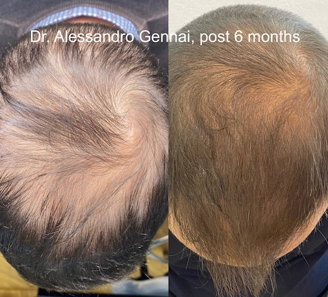 Gennai example Seffihair