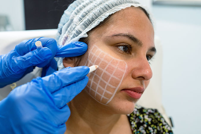 Skin boosters at SE1 Medical Aesthetics London