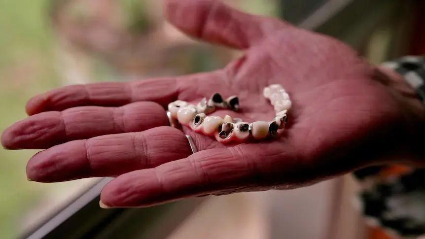 Why You Shouldn't Travel Overseas for Dental IMPLANTS (And What to Do Instead)
