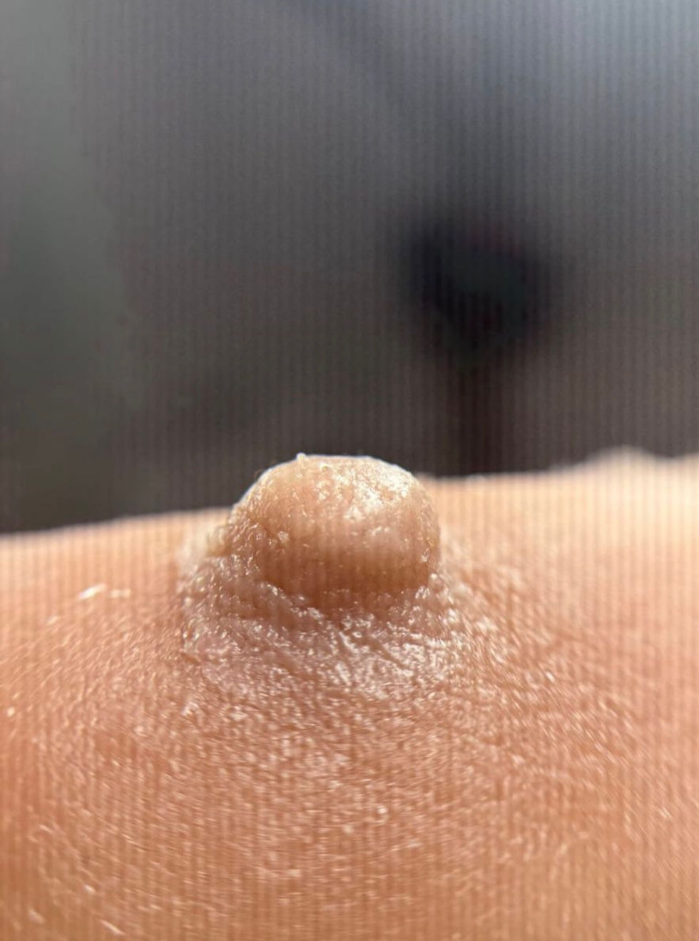 Miniatura: Singolo Capezzolo Protesico Femminile | Post Mastectomia | FTM Top Surgery