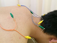 im_treatment9-400x300.jpg