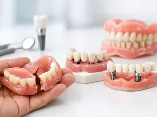 Best Options for Failing Dentures
