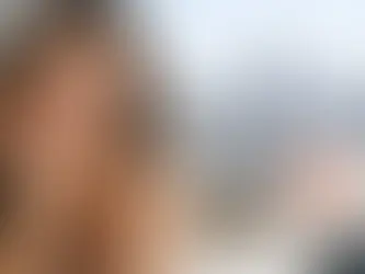 Smile Makeover Cost Breakdown in NYC
