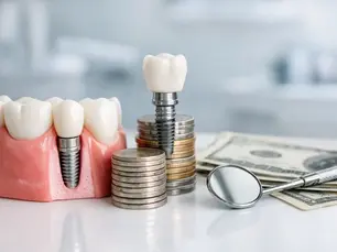 How Much Do Dental Implants Cost?