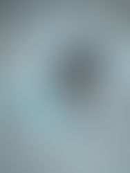 Wearable Technology: Transforming Healthcare Monitoring and Management