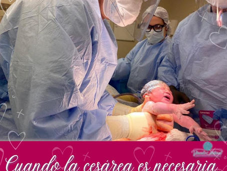 Cuando la cesárea es necesaria...
