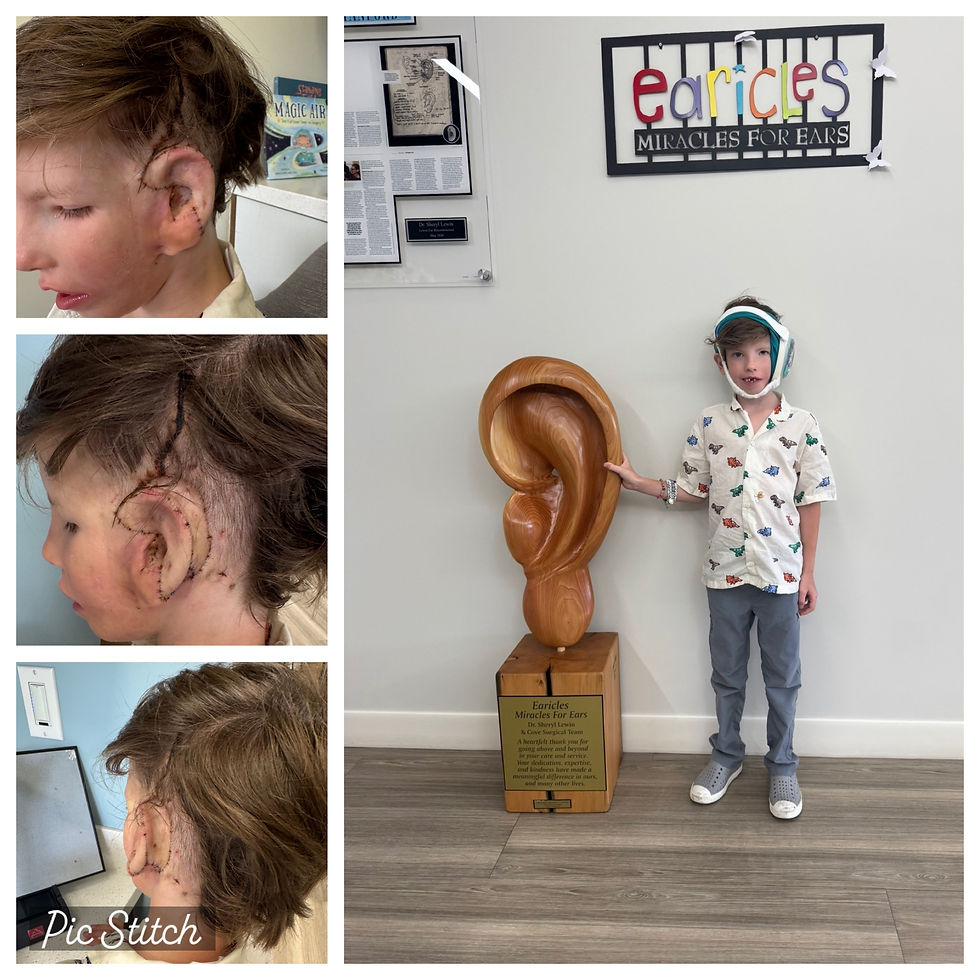 brave bennett + his new big ear!