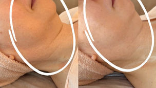 Ipsフェイシャルモニター体験ご感想