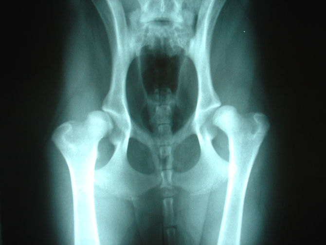 Did You Know that Pelvic Malalignment Can Be the Cause of Your Foot, Ankle or Knee Pain?