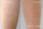 Dialoze Before and After2.jpg