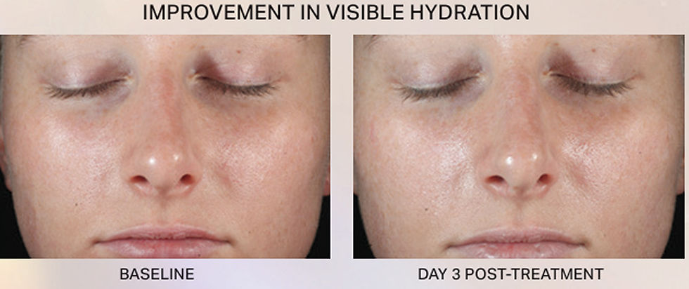 improvement in visible hydration.jpg