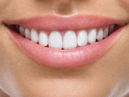 Bao Nhiêu Tuổi Thì Bọc Răng Sứ Được? Hướng Dẫn Chi Tiết