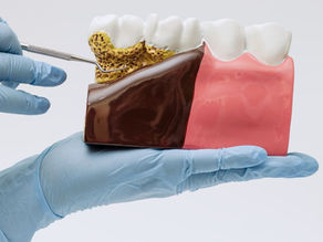 Spring Clean Your Smile: Why Your Gums Deserve Attention Too