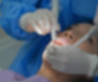 Understanding Deep Cleaning: The Process, Benefits, and Recovery