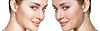 acne-facials.jpeg