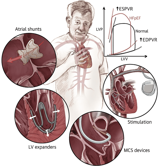 HFpEF devices-min.png