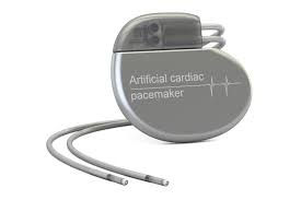 PPM device.jpeg
