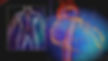 3850378299001_4264531712001_190-Angiogra