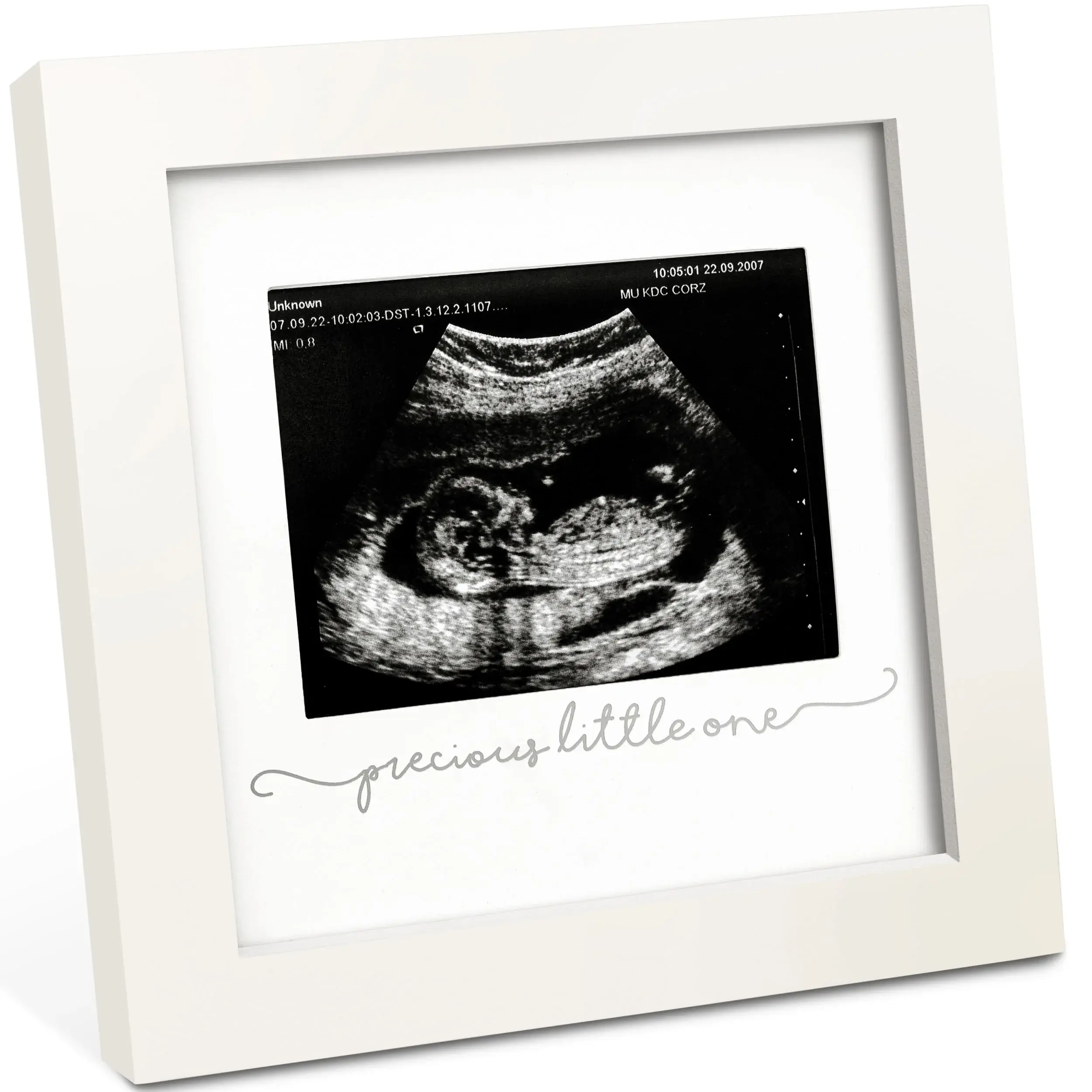 Kea Babies Solo Sonogram Frame (White)